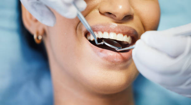 Best After-Hours Dental Care in Caldwell, OH