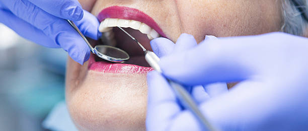 Best Emergency Dental Care for Sports Injuries in Caldwell, OH